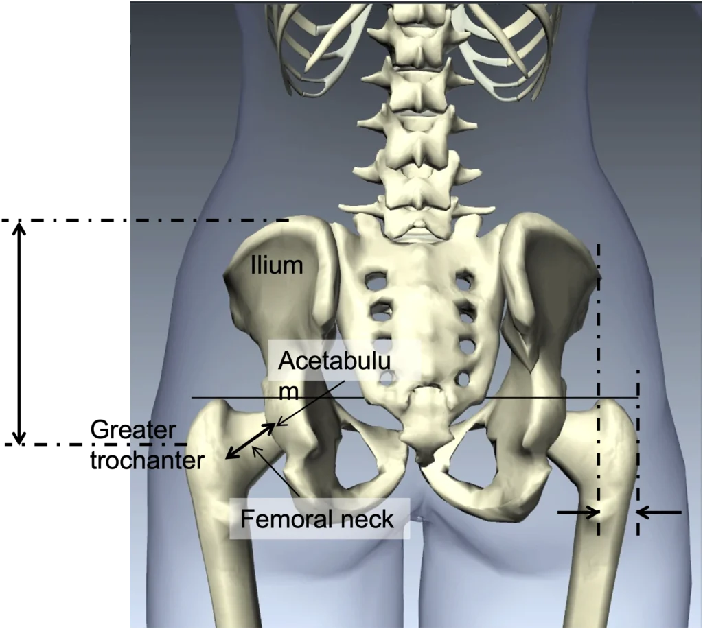 Hip Dip Is NOT A Problem But There Is A Real Problem EverfitSG Hip Dip Is NOT A Problem But There Is A Real Problem EverfitSG